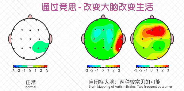 阿斯伯格与自闭症